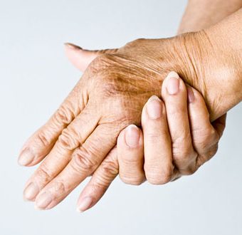 Aging Hands