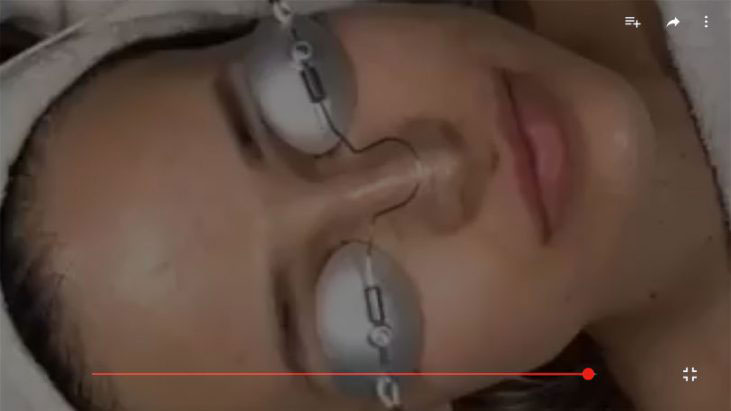 Clear & Brilliant Laser Treatment APT Medical Aesthetics youtube thumbnail