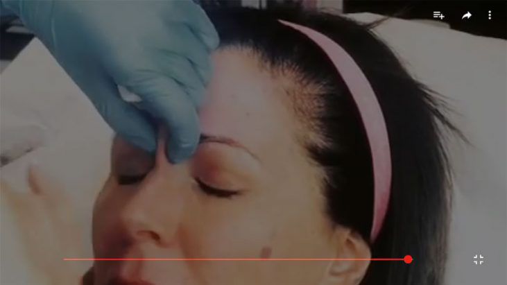 Wrinkles and Fine Lines Treatments - APT Medical Aesthetics youtube thumbnail