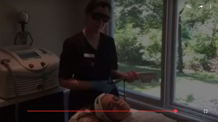 IPL Photo Facial Oakville youtube thumbnail