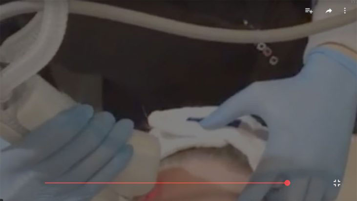 Laser Skin Resurfacing Treatment - APT Medical Aesthetics youtube thumbnail