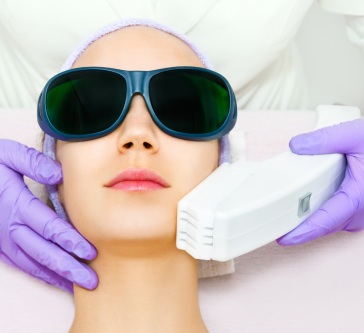 Skintyte Laser Treatment - APT Medical Aesthetics