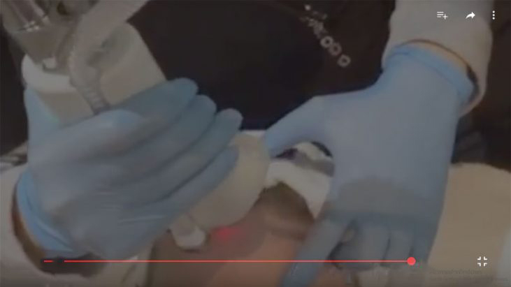 Uneven Skin Texture Treatments - APT Medical Aesthetics youtube thumbnail