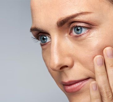 Wrinkles and Fine Lines Treatments - APT Medical Aesthetics
