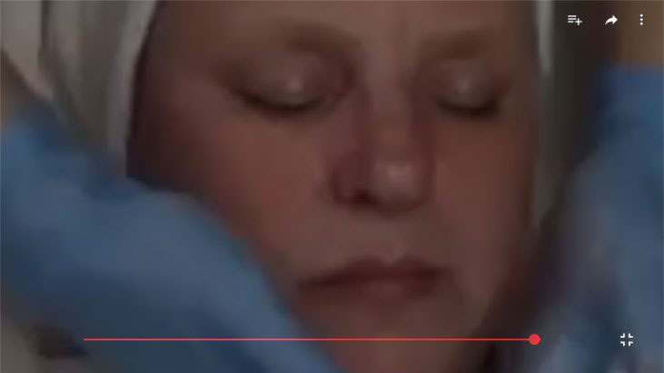 Chemical Peels - APT Medical Aesthetics youtube thumbnail