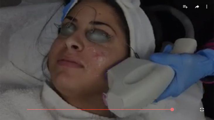 Acne & Blemish Treatment - APT Medical Aesthetics youtube thumbnail