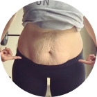 Sagging