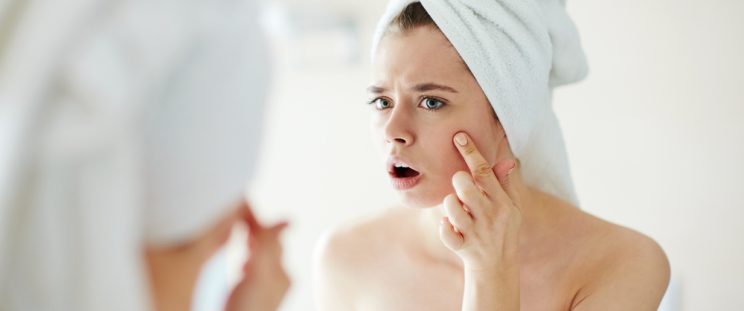 Young woman wearing a towel, worrying about skin purging