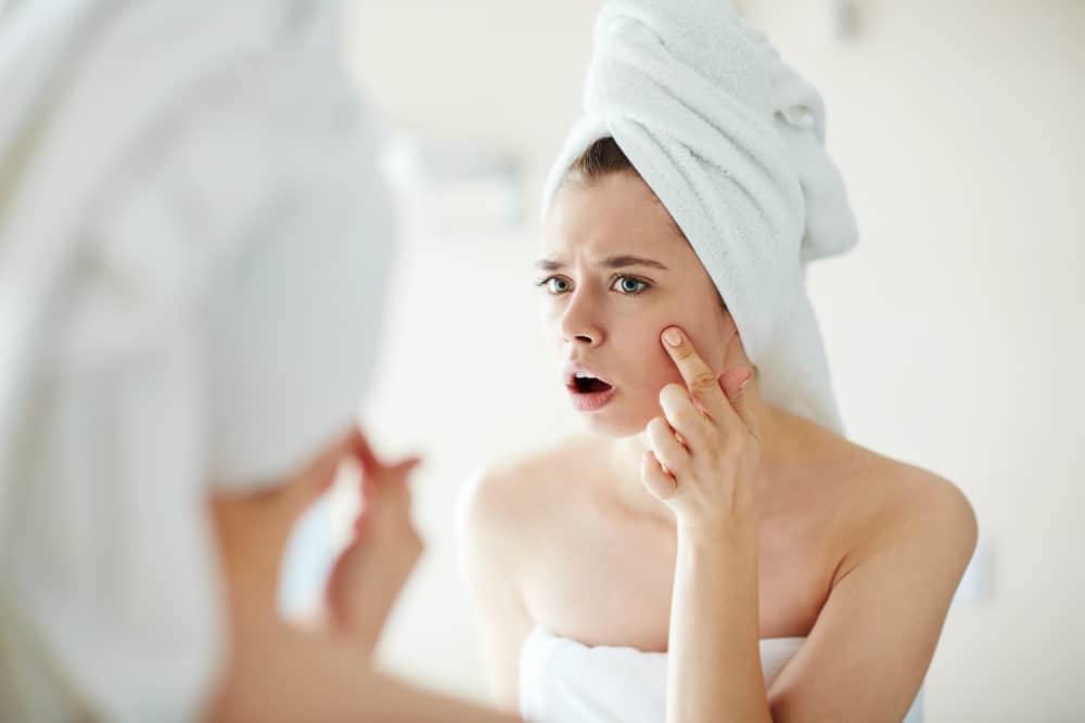 Young woman wearing a towel, worrying about skin purging