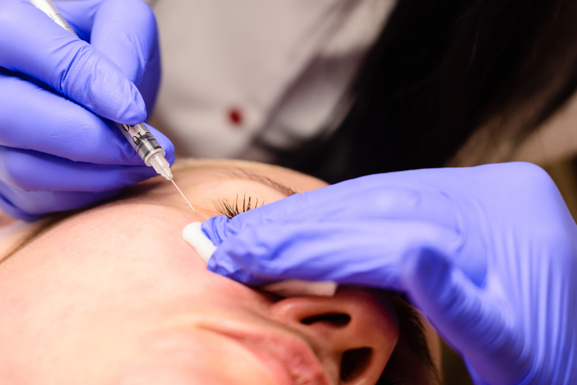a person getting a white hard bump under eye removed
