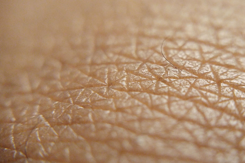 Close up of skin