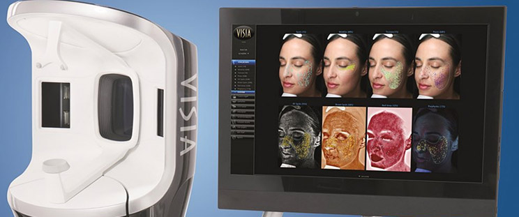 The Canfield VISIA Complexion Analysis System