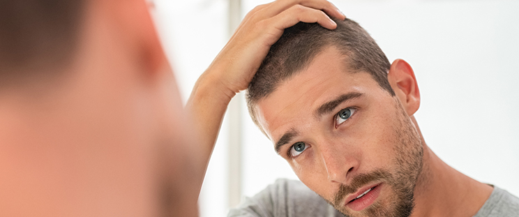 How to Fix Thinning Hair or a Receding Hairline | APT Medical Aesthetics How to Fix Thinning Hair or a Receding Hairline | APT Medical Aesthetics