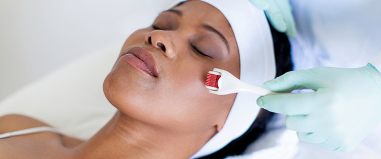 Miicroneedling Treatment - APT Medical Aesthetics