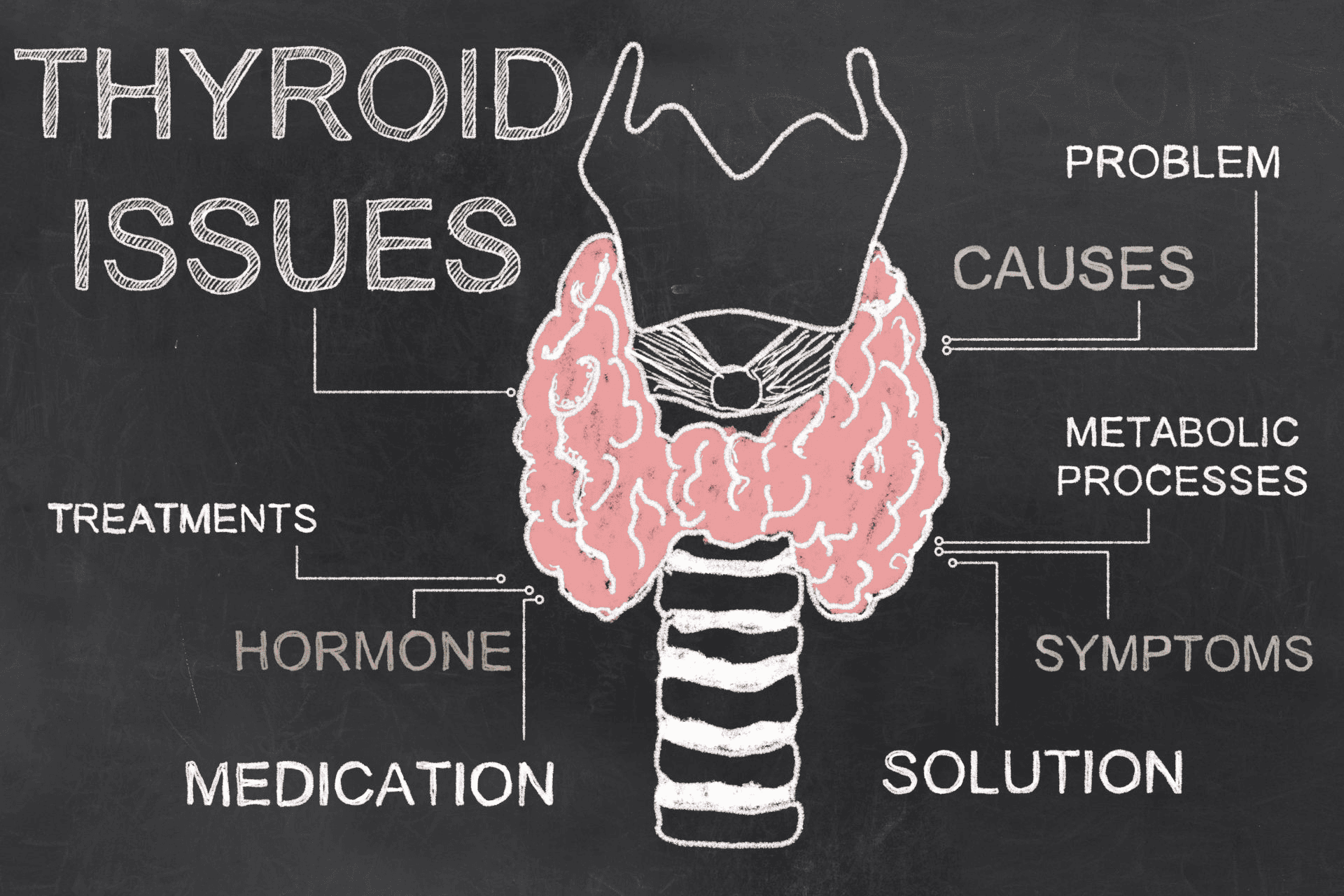  A chart showing how thyroid issues affect the body. 