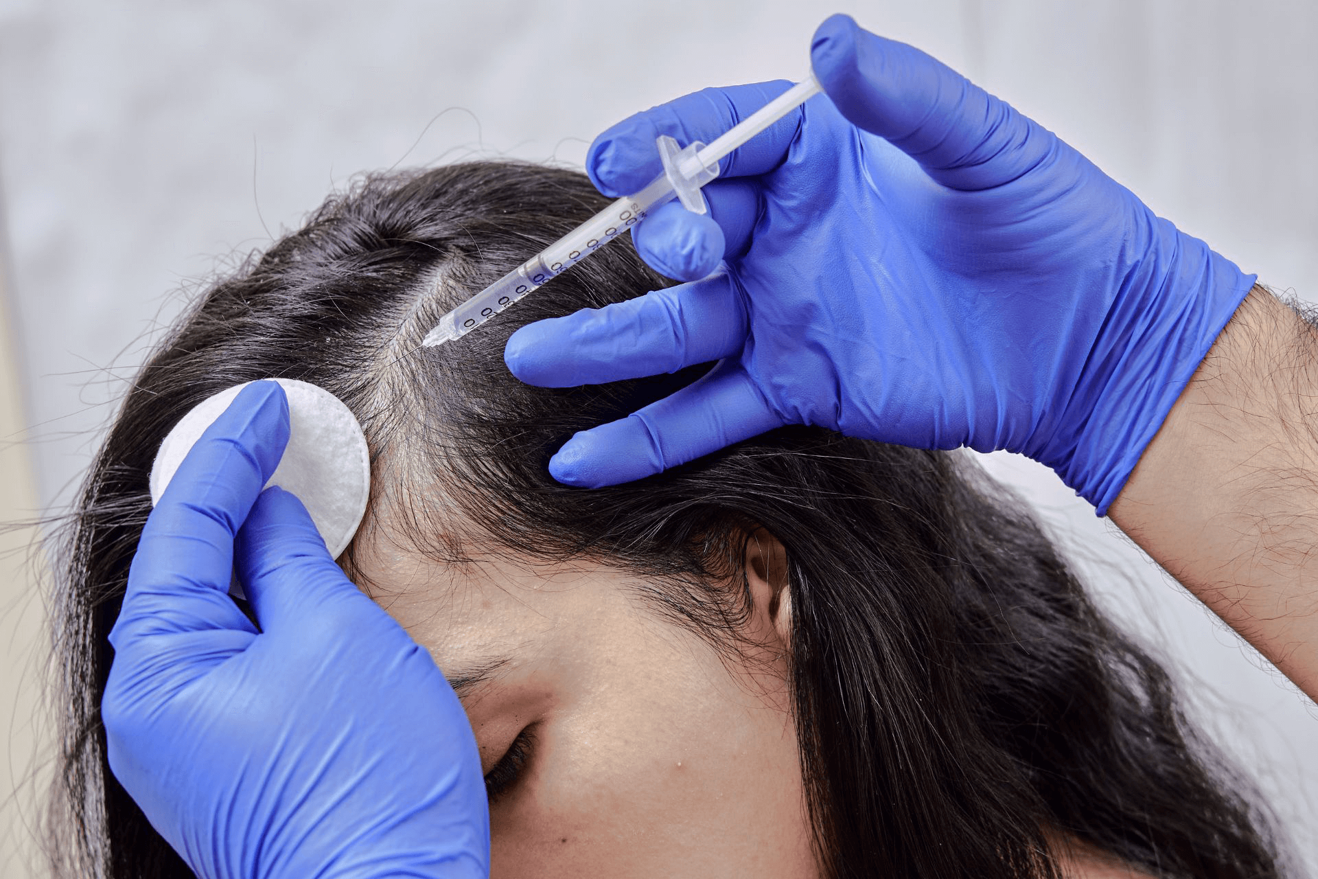 A person getting treatment for their thinning hair.
