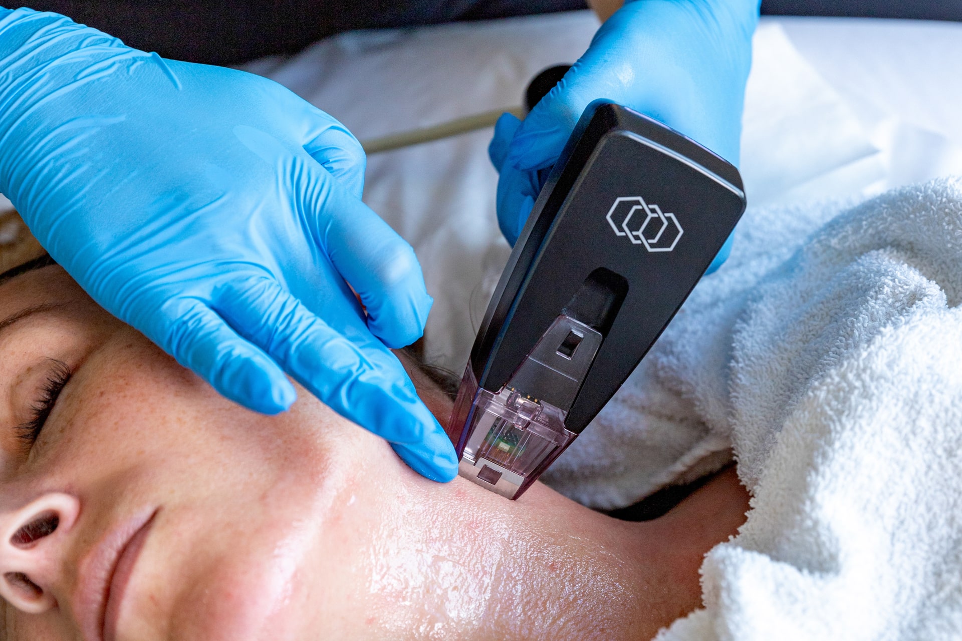 A medical aesthetician uses Morpheus8 on a patient’s neck to make the skin tighter 